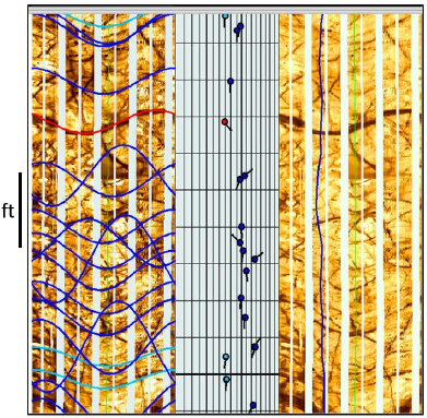 Fracture Analysis